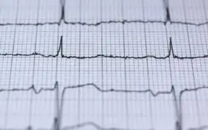 heartbeat