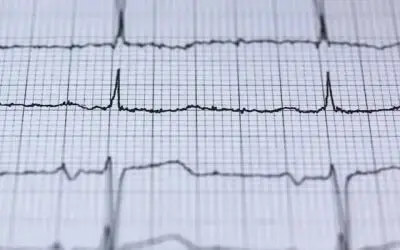 heartbeat