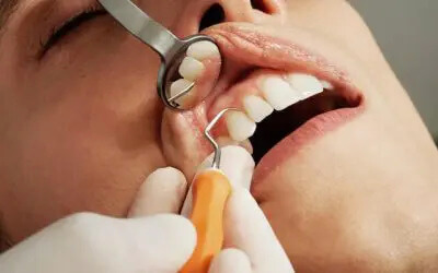 man getting a dental exam