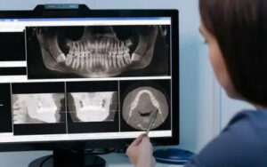 dentist pointing to xrays on screen
